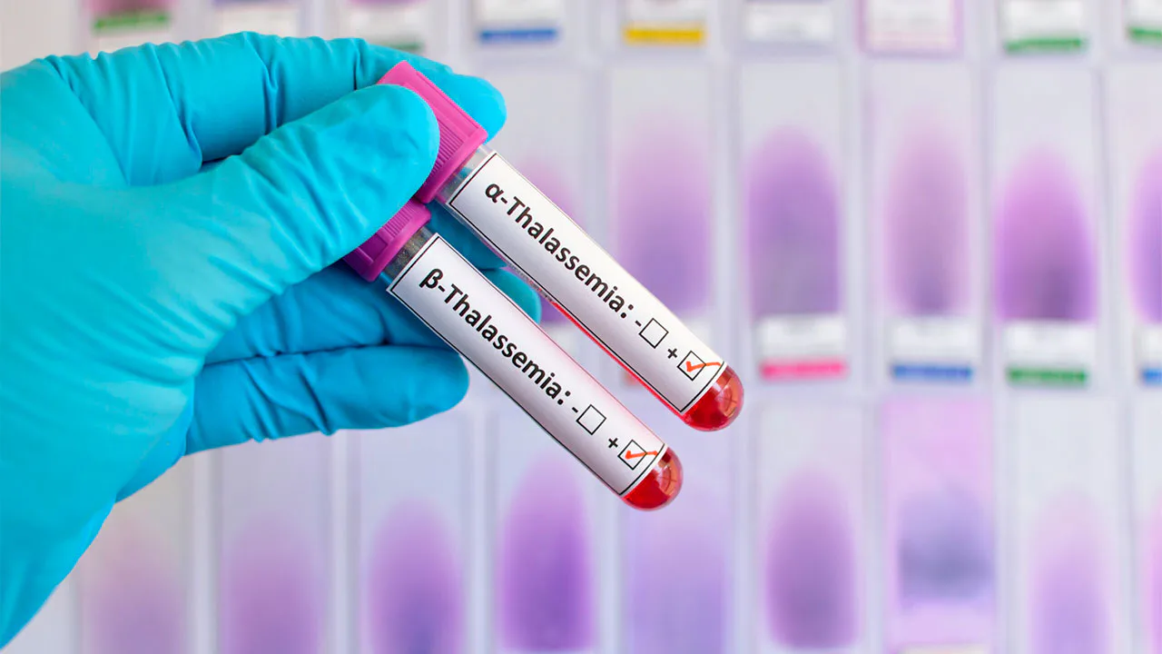 Os tipos de Talassemia