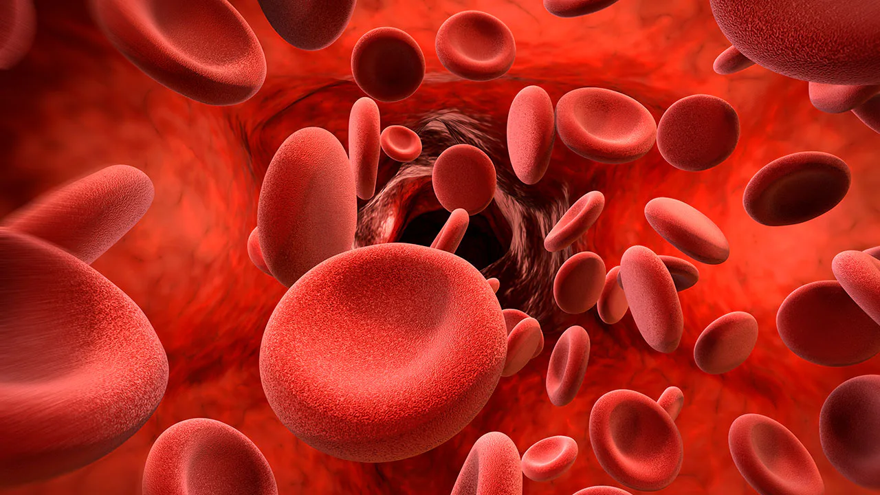 Talassemia Intermediária