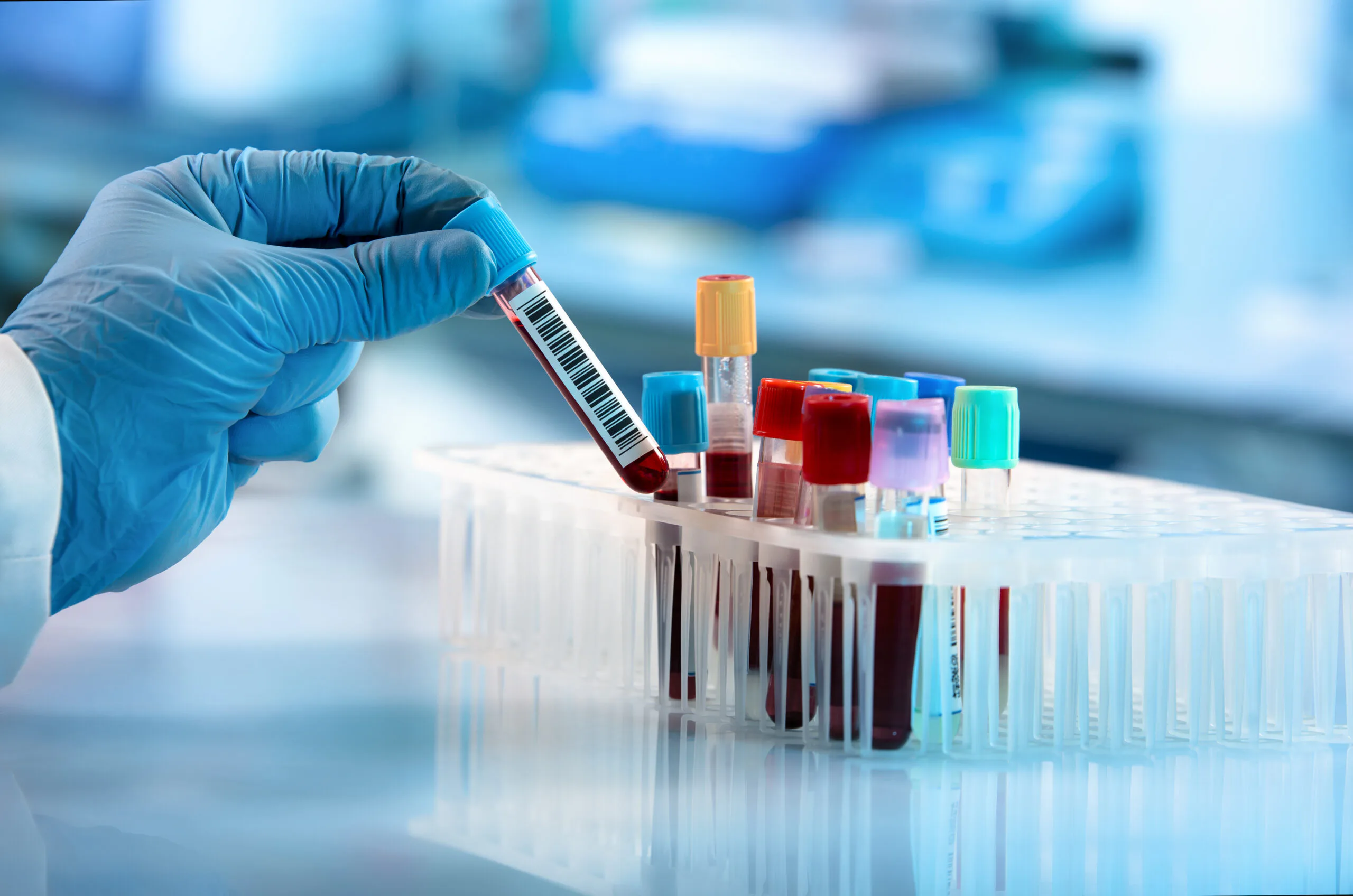 Imagem 4 de Segurança do sangue