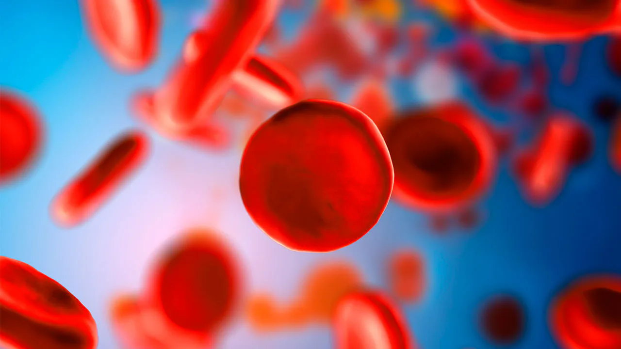 Talassemia Maior